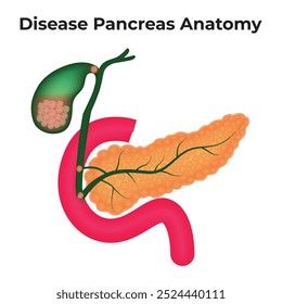 Disease Pancreas Anatomy Vector Illustration