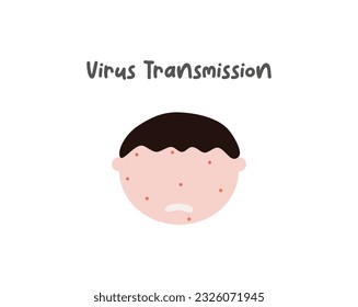 Disease and virus spread illustration. Covid19, influenza, bacterial infection transmission. Virus outbreak ways vector illustrations. Virus transmission from chicken pox or small pox.