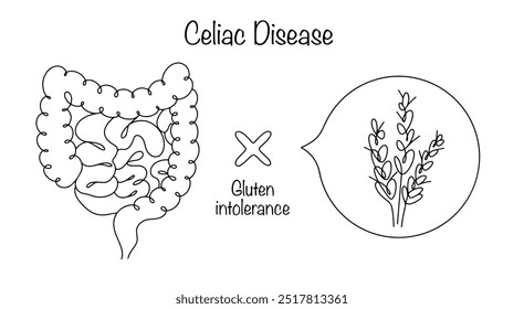 Enfermedad en la que el intestino Pequeño de un adulto no produce ciertas enzimas responsables de la descomposición del gluten, lo que lleva a una disfunción del tracto gastrointestinal. Ilustración vectorial.