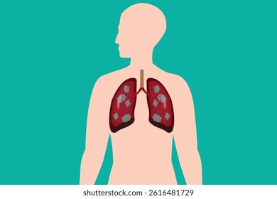 Diseased lungs illustration inside human body silhouette on teal background, medical concept. eps 10