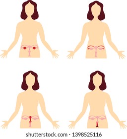 Diseases of the female reproductive system. Scheme of the human body. Anatomical image.
