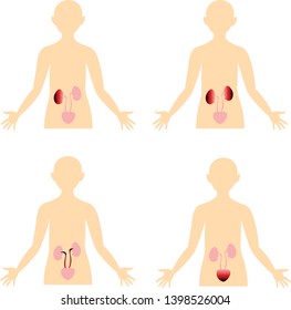 Diseases of the urinary system. Scheme of the human body. Anatomical image. Inflammation, infection.
