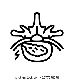 diskectomy patient disease line icon vector. diskectomy patient disease sign. isolated contour symbol black illustration
