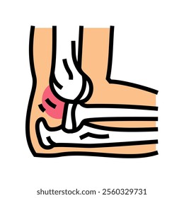 dislocated joint fracture color icon vector. dislocated joint fracture sign. isolated symbol illustration