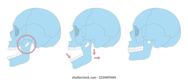 dislocation skull vector illustration image