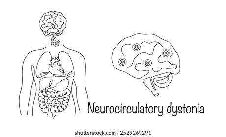 Trastorno en el cual el control del sistema nervioso sobre las funciones de los órganos internos se ve afectado. Problema dibujado a mano en el trabajo entre el cerebro y los órganos internos. Ilustración de línea de Vector.