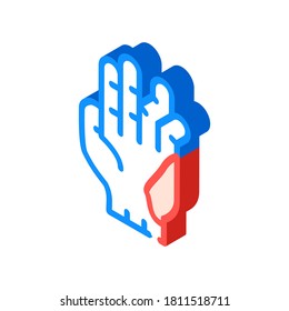 displaced fracture isometric icon vector. displaced fracture sign. isolated symbol illustration