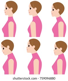 Distortion of the neck