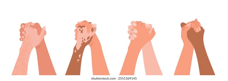 Manos diversas que se mantienen juntas. Cooperación de Equipo, Asistencia, concepto de confianza. Albinismo, vitiligo, manchas de pigmento. Vector plano