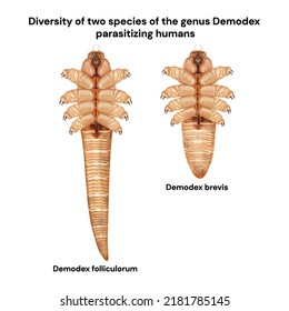 Diversity Of Two Species Of The Genus Demodex Parasitizing Humans. Eyelash Mites. Demodex Mite. Demodex Folliculorum And Demodex Brevis.