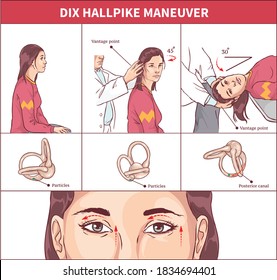 Dix Hallpike Maneuver Vector illustration