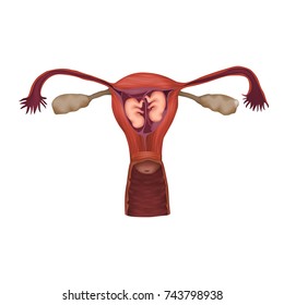 Dizygotic Twins, Embryo, Fetus In Uterus, Placenta, Umbilical Cord. Vector Medical Illustration. Colored Image, White Background.