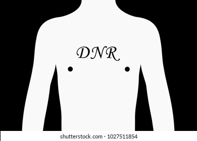 DNR ( Do Not Resuscitate ) text on the body of patient. Living will to not rescue and and save person by medical doctors. Refusal and rejection of resuscitation. Vector illustration