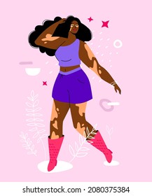 Do not be shy about vitiligo - colorful flat design style illustration