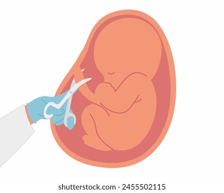 doctor cutting the umbilical cord after doctor successfully deliver a baby vector illustration