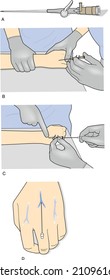 Doctor hands syringe and ampoule with vaccine or medicine. Doctor hands giving injection. Vaccination and vaccination concept. Preventive medicine, treatment. Colorful set. Isolated. Vector