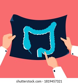 Doctor Holding Colon Xray Vector Illustration. Medical Checkup Banner In Flat Cartoon Style. Healthcare Background.