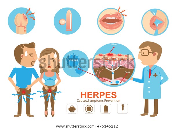 Doctor holding diagram Herpes on the lips and\
genitals of the young woman And young men. Cartoon vector\
illustration And\
genitals