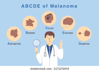 Doctor Holding Magnifies Glass With 5 Characteristics Of Skin Damage From Cancer And Melanoma. Illustration About Diagnosis And Classification Of Melanoma By Use ABCDE Letter.