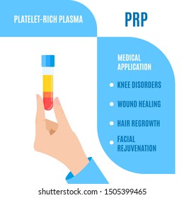 Doctor Holding A Test Tube With Blood For Platelet Rich Plasma Injection. Medical Use Of PRP For Wound Healing, Hair Regrowth, Facial Rejuvenation, Joint Disorder Treatment. Stem Cell Regeneration.