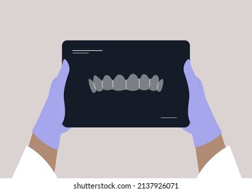 Doctor holding an x-ray teeth scan, dentist treatment 