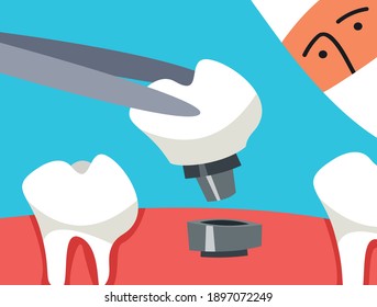 Doctor holds the tooth in forceps. Oral care concept. Flat vector illustration.