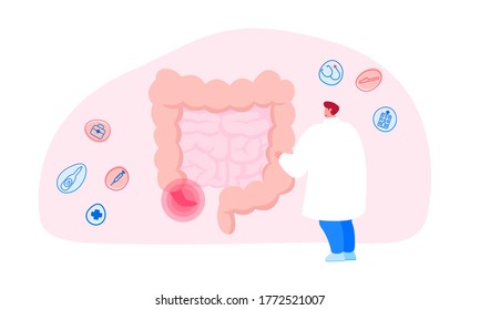 Doctor or Medic Character Stand at Huge Human Intestines with Sore Appendix Infographics Aid Decide Strategy of Treatment. Abdominal Pain, Gastrointestinal System Disease. Cartoon Vector Illustration