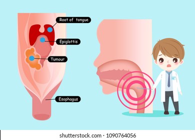 doctor with oral cancer concept on the blue background