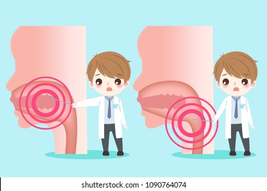 doctor with oral cancer concept on the blue background