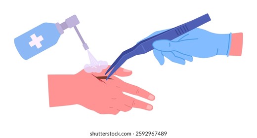 Doctor pull out splinter. Cartoon first aid for body skin trauma, medical treatment for arm injury flat vector illustration. Injured human hand and medical treatment