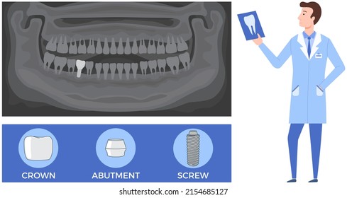 Doctor talking about dental prosthesis structure. Implantation dentistry, stomatology. Tooth care, treatment. Dental implant creation scheme. Sequence of connection of screw, abutment and crown