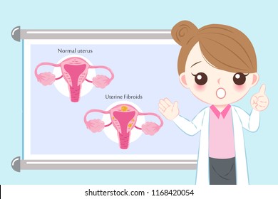 Doctor With Uterine Fibroids Concept On The Blue Background