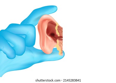 Die Hand des Arztes in blauen Handschuhen hält menschliches Ohr einzeln auf weißem Hintergrund. Vektorgrafik.