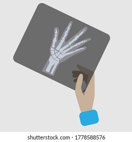 doctor`s hand holds x ray image of hand, flat illustration, medical diagnosis concept, vector element for anatomy, surgery and x ray infographic.