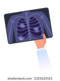 Doctor`s Hand holds X-ray image of damaged human lungs. MRI scan of Pneumonia, pulmonary fibrosis, smoker tuberculosis, dust in lungs or cancer concept. Shortness of breath, chest pain flat isolated