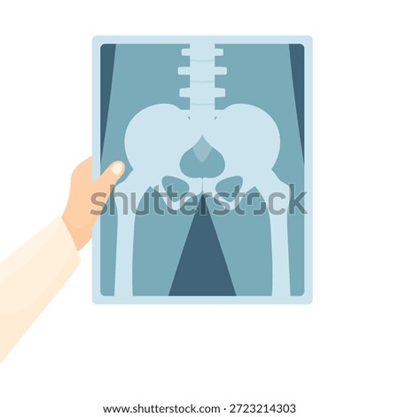 A doctor's hand in a white coat holding an X-ray of the pelvis against a white background. Concept for diagnosing bone problems and fractures. Elements of medicine. Pelvic floor.