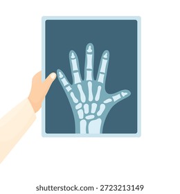 Eine Hand eines Arztes in einem weißen Mantel hält eine Röntgenaufnahme einer Hand auf weißem Hintergrund. Konzept zur Diagnose von Knochenproblemen und Knochenbrüchen. Elemente der Medizin