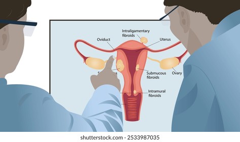 Doctors looking at ultrasound of woman with uterine fibroids, gynecological cancer, heavy menstruation