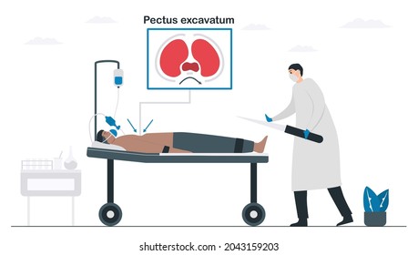 Doctors are operating a patient that is pectus excavatum. Pulmonology vector illustration about restrictive lung disease. Minimal design.