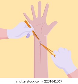 Doctors are suturing the wound after the surgery is complete.
Illustration about stitches.
Healthcare and medical concept.