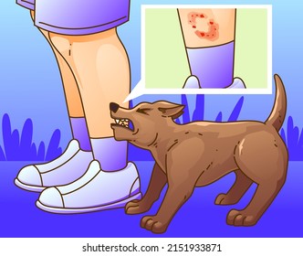 Dog aggression. The dog bites the human. Vector illustration.