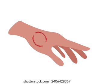 Dog bite mark on hand in flat design on white background.