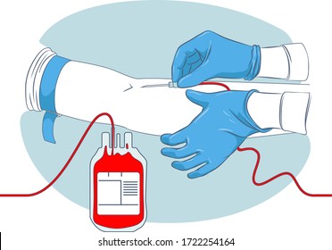 Proceso de recolección de sangre de donantes, las manos de una enfermera se preparan para instalar una aguja de recolección de sangre de donante en el brazo de un donante