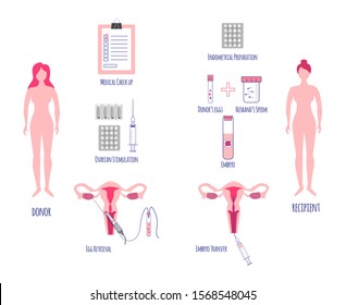 Donor And Recipient Preparation. Egg Donation. Egg Retrieval. Embryo Transfer. In Vitro Fertilization.Vector Illustration.