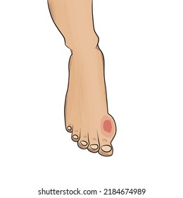 Doodle hand drawn gout disease colored linework