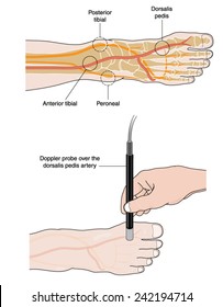 Doppler probe measurement of pedal pulse, showing the major pedal pulse points with named arteries. Created in Adobe Illustrator.  Contains transparencies.  EPS 10.