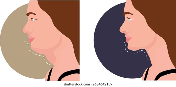 Double chin before and after images showcase the visible transformation achieved through cosmetic procedures such as liposuction, Kybella injections, laser fat removal, or weight loss.