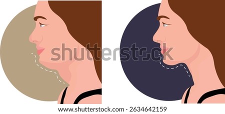 Double chin before and after images showcase the visible transformation achieved through cosmetic procedures such as liposuction, Kybella injections, laser fat removal, or weight loss.