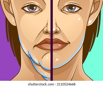 Double chin. Before, After. The woman shows the age problems on her face. Healthcare illustration. Vector illustration.