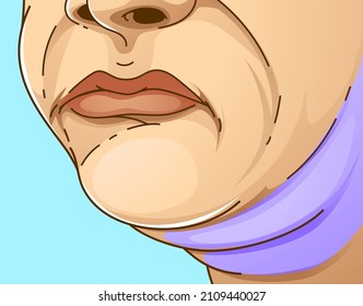 Double chin. The woman with the age problems on her face. Healthcare illustration. Vector illustration. 